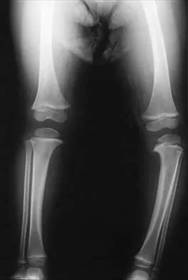 Pediatrics 2026 MCQs: Board Review Questions & Answers (Part 1) - Figure 84