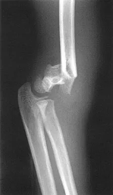 Pediatrics 2026 MCQs: Board Review Questions & Answers (Part 2) - Figure 113