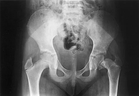 Pediatrics 2026 MCQs: Board Review Questions & Answers (Part 2) - Figure 115