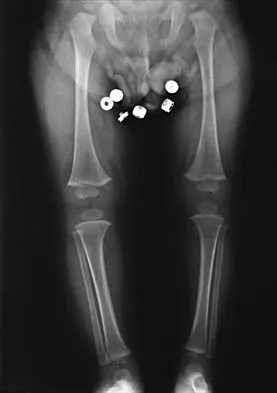 Pediatrics 2026 MCQs: Board Review Questions & Answers (Part 2) - Figure 21