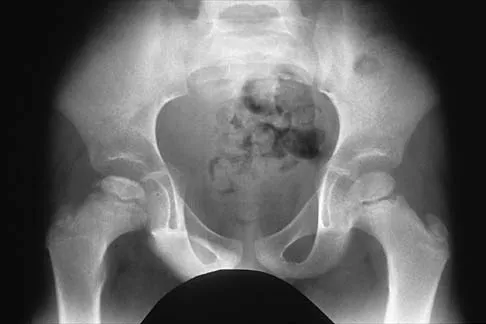 Pediatrics 2026 MCQs: Board Review Questions & Answers (Part 2) - Figure 23