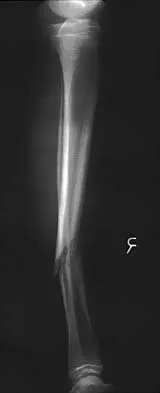 Pediatrics 2026 MCQs: Board Review Questions & Answers (Part 2) - Figure 27