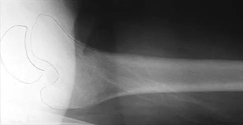 Pediatrics 2026 MCQs: Board Review Questions & Answers (Part 2) - Figure 33