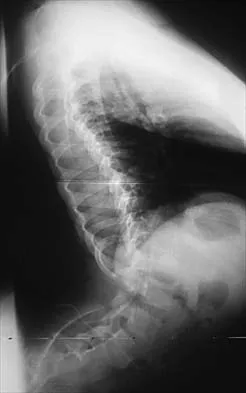 Pediatrics 2026 MCQs: Board Review Questions & Answers (Part 2) - Figure 43