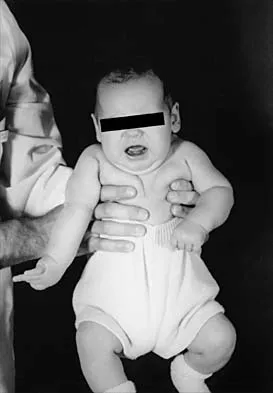 Pediatrics 2026 MCQs: Board Review Questions & Answers (Part 2) - Figure 57