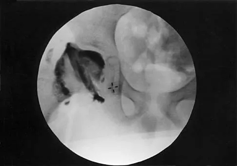 Pediatrics 2026 MCQs: Board Review Questions & Answers (Part 2) - Figure 69