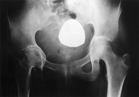 Pediatrics 2026 MCQs: Board Review Questions & Answers (Part 2) - Figure 83