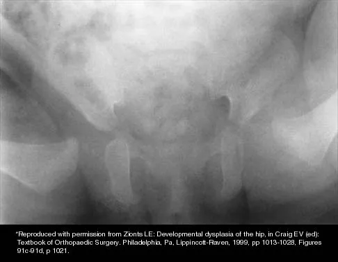 Pediatrics 2026 MCQs: Board Review Questions & Answers (Part 3) - Figure 39