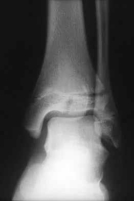 Pediatrics 2026 MCQs: Board Review Questions & Answers (Part 3) - Figure 45