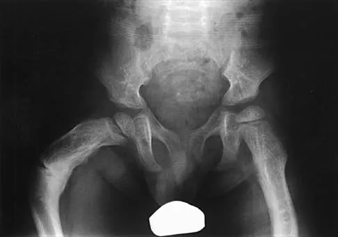 Pediatrics 2026 MCQs: Board Review Questions & Answers (Part 3) - Figure 49