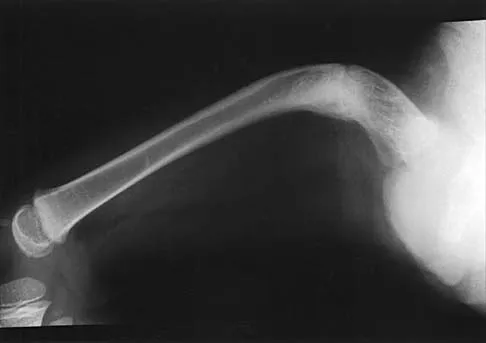 Pediatrics 2026 MCQs: Board Review Questions & Answers (Part 3) - Figure 51