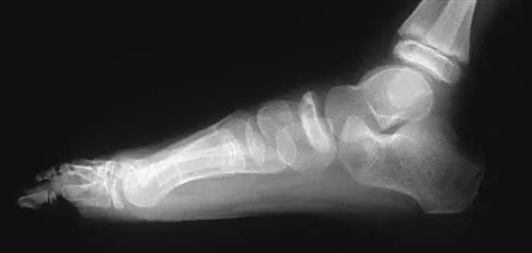 Pediatrics 2026 MCQs: Board Review Questions & Answers (Part 3) - Figure 7