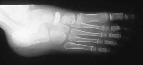 Pediatrics 2026 MCQs: Board Review Questions & Answers (Part 3) - Figure 9