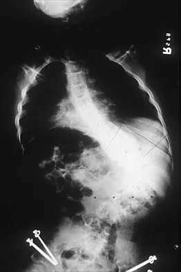 AAOS Orthopedic Pediatrics MCQs (Part 4): Hip Dysplasia & Lower Extremity Trauma | 2026 Board Review