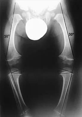 Pediatrics 2026 MCQs: Board Review Questions & Answers (Part 4) - Figure 11