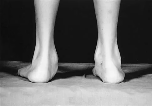 Pediatrics 2026 MCQs: Board Review Questions & Answers (Part 4) - Figure 13