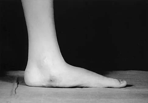 Pediatrics 2026 MCQs: Board Review Questions & Answers (Part 4) - Figure 15