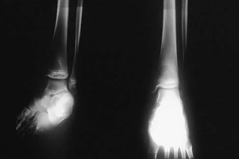 Pediatrics 2026 MCQs: Board Review Questions & Answers (Part 4) - Figure 25