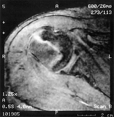 Shoulder 2000 Practice Questions: Set 1 (Solved) - Figure 16