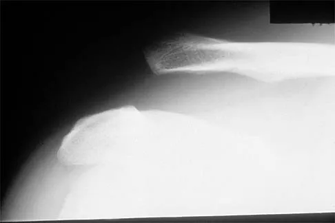 Shoulder 2000 Practice Questions: Set 1 (Solved) - Figure 21