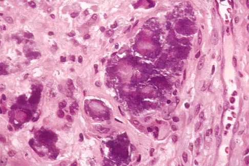 Shoulder 2000 Practice Questions: Set 1 (Solved) - Figure 28