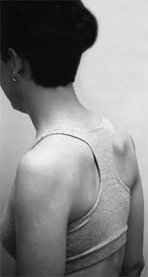 Shoulder 2000 Practice Questions: Set 1 (Solved) - Figure 31