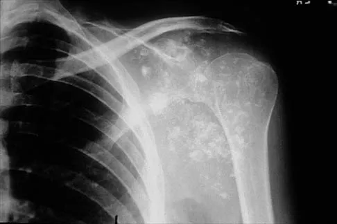 Shoulder Board Review 2000: High-Yield MCQs (Set 2) - Figure 10