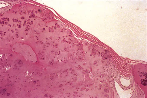 Shoulder Board Review 2000: High-Yield MCQs (Set 2) - Figure 13