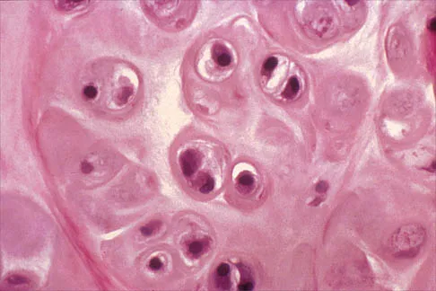 Shoulder Board Review 2000: High-Yield MCQs (Set 2) - Figure 14