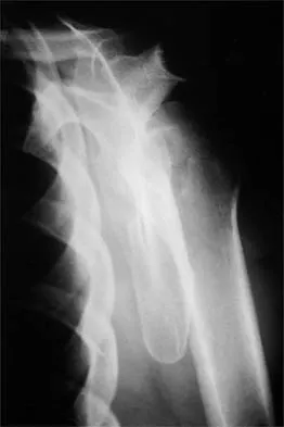 Shoulder Board Review 2000: High-Yield MCQs (Set 2) - Figure 2