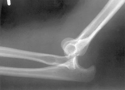 Shoulder 2000 Practice Questions: Set 3 (Solved) - Figure 18