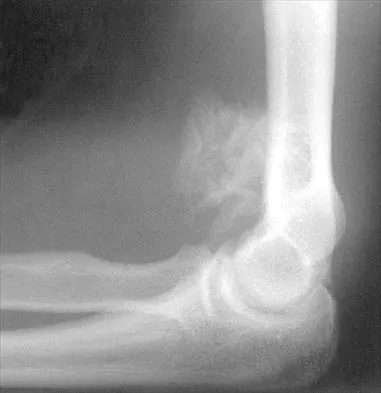 Shoulder 2000 Practice Questions: Set 3 (Solved) - Figure 2