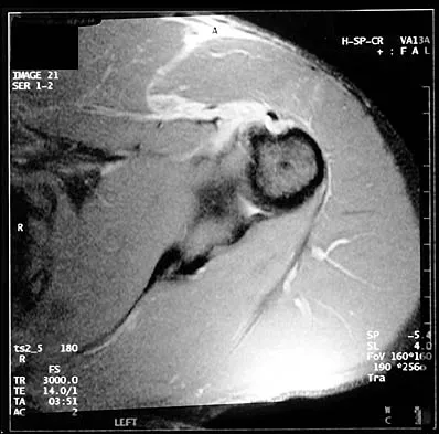 Shoulder 2000 Practice Questions: Set 3 (Solved) - Figure 4