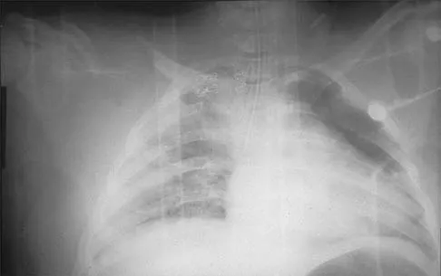 Shoulder Board Review 2000: High-Yield MCQs (Set 4) - Figure 13