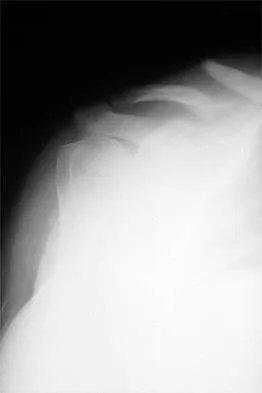 Shoulder 2002 Practice Questions: Set 1 (Solved) - Figure 8