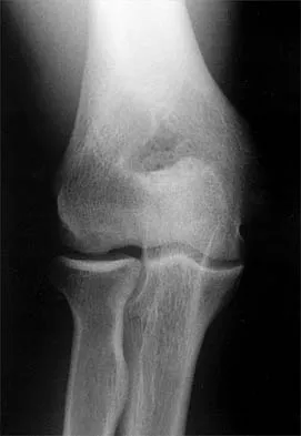 Shoulder Board Review 2002: High-Yield MCQs (Set 2) - Figure 15