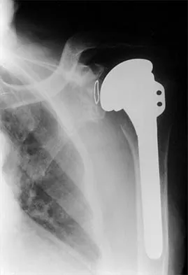 Shoulder Board Review 2002: High-Yield MCQs (Set 2) - Figure 26