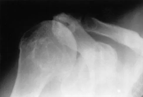 Shoulder 2002 Practice Questions: Set 3 (Solved) - Figure 3