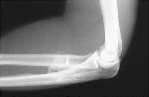 Shoulder Board Review 2002: High-Yield MCQs (Set 4) - Figure 15