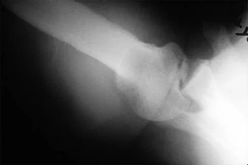 Shoulder Board Review 2002: High-Yield MCQs (Set 4) - Figure 2