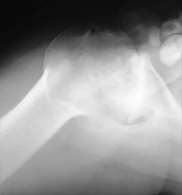 Shoulder 2026 MCQs: Board Review Questions & Answers (Part 1) - Figure 109