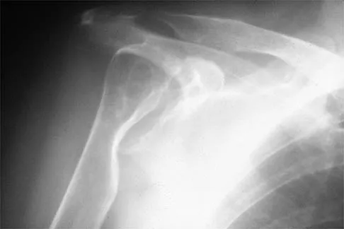 Shoulder 2026 MCQs: Board Review Questions & Answers (Part 1) - Figure 111