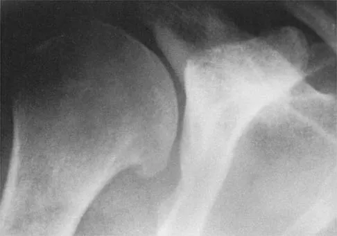 Shoulder 2026 MCQs: Board Review Questions & Answers (Part 1) - Figure 17