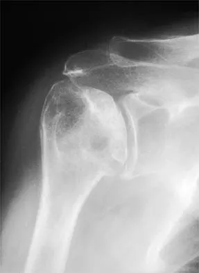 Shoulder 2026 MCQs: Board Review Questions & Answers (Part 1) - Figure 29