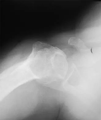 Shoulder 2026 MCQs: Board Review Questions & Answers (Part 1) - Figure 31