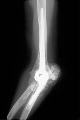 Shoulder 2026 MCQs: Board Review Questions & Answers (Part 1) - Figure 35