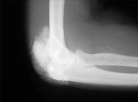 Shoulder 2026 MCQs: Board Review Questions & Answers (Part 1) - Figure 41