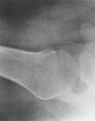 Shoulder 2026 MCQs: Board Review Questions & Answers (Part 1) - Figure 49