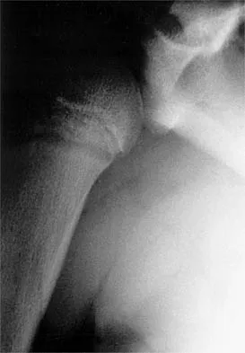 Shoulder 2026 MCQs: Board Review Questions & Answers (Part 1) - Figure 53