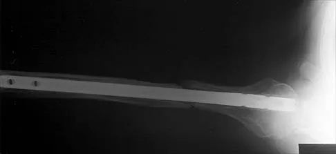 Shoulder 2026 MCQs: Board Review Questions & Answers (Part 1) - Figure 81